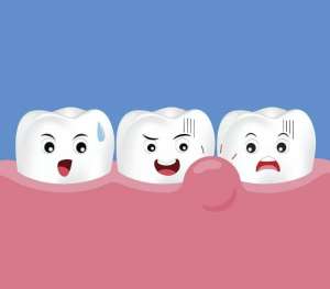 儿童牙龈炎是怎么形成的？日常生活中需要注意哪些方面？