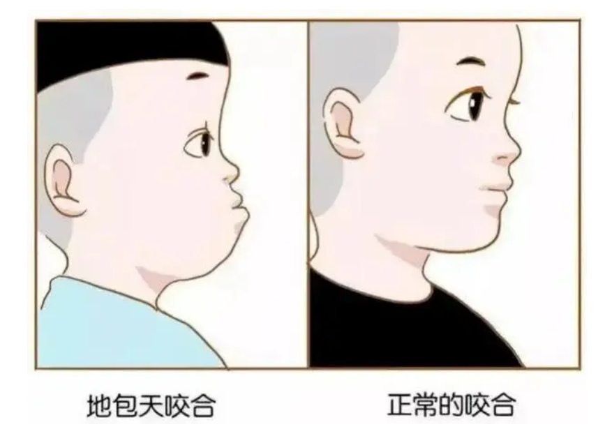 22岁了还能做牙齿矫正吗？