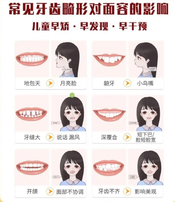 如何进行儿童牙齿早期干预？