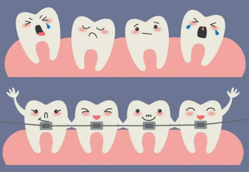 牙齿矫正可以做半口的吗？