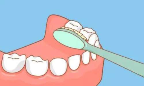 重新定义“牙齿健康”:不痛不等于健康