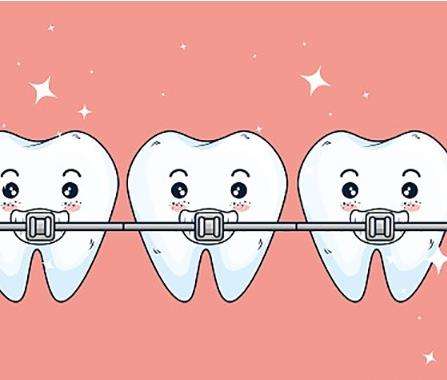 矫正牙齿为什么要带橡皮筋？
