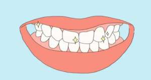 为什么牙根会越来越长？越来越细了？