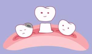 老人牙齿掉光了可以做全口假牙吗？