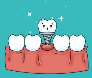 种植牙后牙齿会发炎吗？日常应该怎样维护？