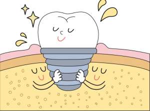 年轻人牙齿脱落一定要种牙吗？看需求选