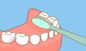 做了牙周基础治疗，多久能评估种牙？