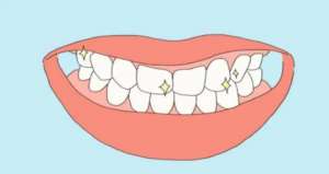 长时间缺牙有哪些危害？种植牙，烤瓷牙哪种补救好？