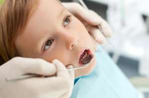 儿童牙齿矫正活动器有哪些？效果都怎么样？