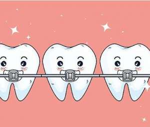 牙齿健康的5大危险信号是什么？你知道吗？