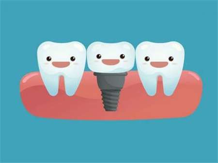 种植牙术后多久能吃螃蟹？