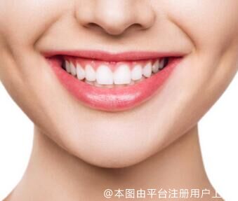 选择牙齿贴面时要注意什么？