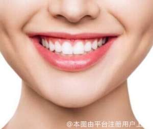 选择牙齿贴面时要注意什么？