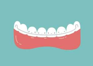 牙缝大能做牙齿矫正吗?