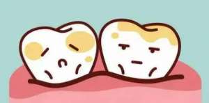 成年人树脂材料补牙用多久？