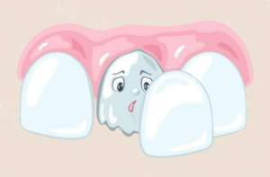 门牙掉了怎么修补？影响补牙价格的因素